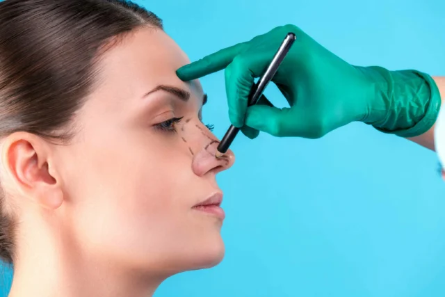 Nose Surgery